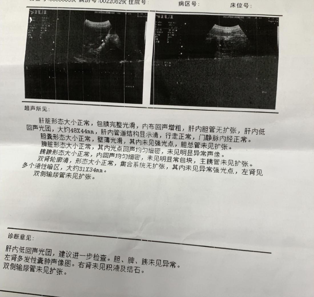 女子孕晚期确诊肝癌，孩子平安出生——生命的奇迹与希望之光